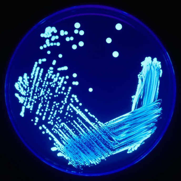 Legionella pneumophila pod elektronovým mikroskopem. Autor: CDC (PHIL #1187) – CDC Public Health Image Library.
