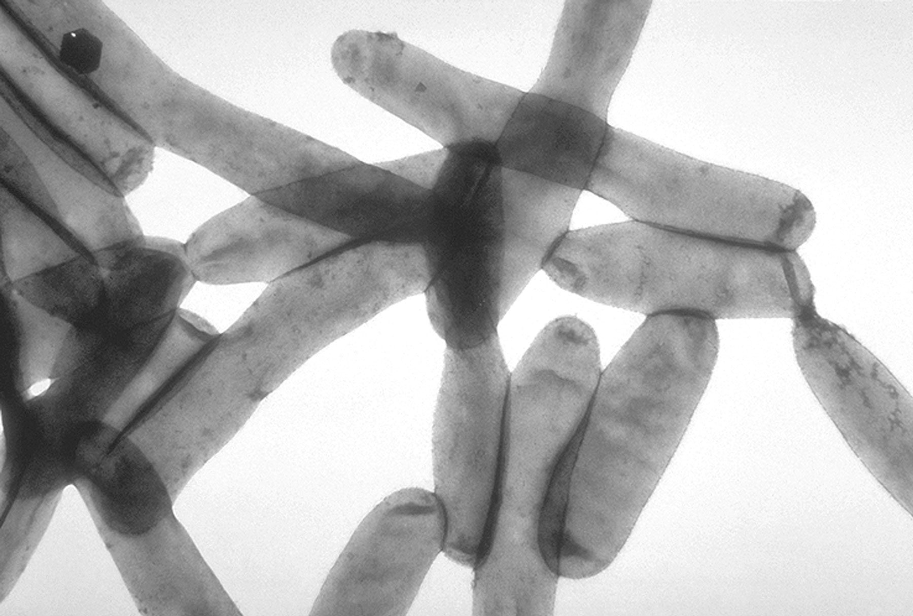 Kulovité kolonie Legionelly na agaru v Petriho misce pro vyšší kontrast pod UV zářením. Autor: CDC/James Gathany – CDC Public Health Image Library (ID#: 7925).